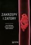 Zakrzepy i zatory
