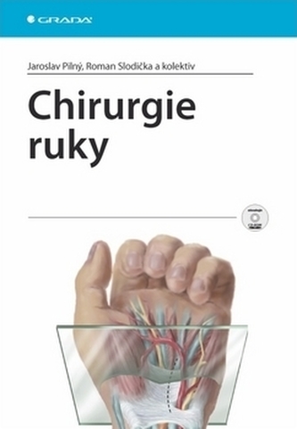 Chirurgie ruky