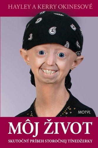 Môj život Môj život