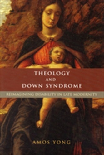 Theology and Down Syndrome