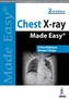 Chest X-ray Made Easy
