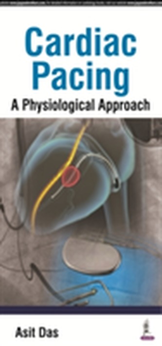 Cardiac Pacing A Physiological Approach