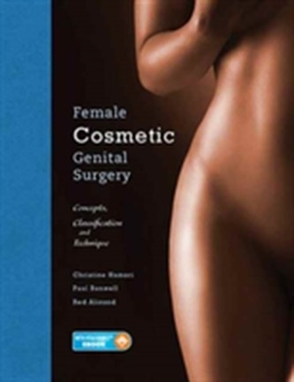 Female Cosmetic Genital Surgery
