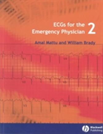ECGs for the Emergency Physician 2