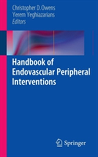 Handbook of Endovascular Peripheral Interventions