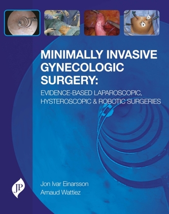 Minimally Invasive Gynecologic Surgery: Evidence-Based Laparoscopic, Hysteroscopic & Robotic Surgeries