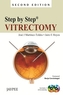 Step by Step: Vitrectomy
