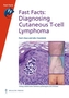 Fast Facts: Diagnosing Cutaneous T-cell Lymphoma