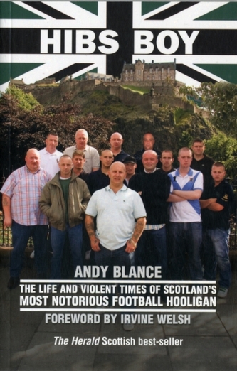Hibs Boy