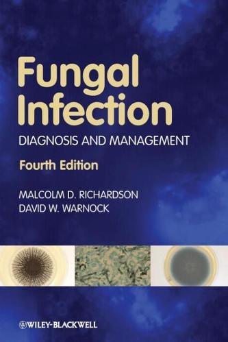 Fungal Infection