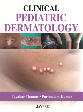 Clinical Pediatric Dermatology