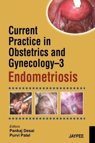 Current Practice in Obstetrics and Gynecology Endometriosis