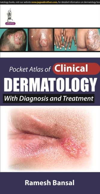 Pocket Atlas of Clinical Dermatology