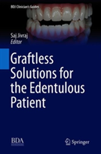 Graftless Solutions for the Edentulous Patient
