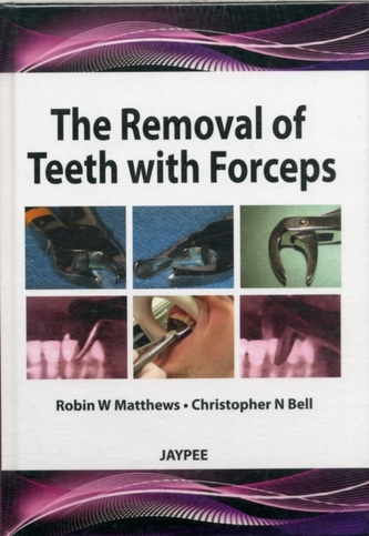 The Removal of Teeth with Forceps