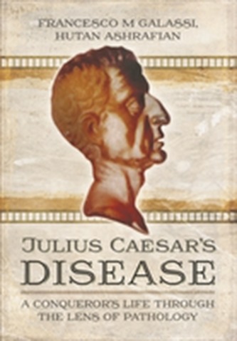 Julius Caesar's Disease
