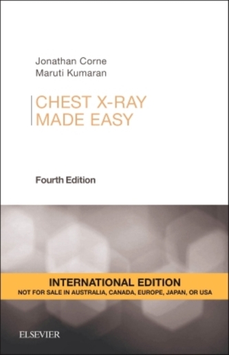 Chest X-Ray Made Easy