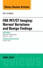 FDG PET/CT Imaging: Normal Variations and Benign Findings - Translation to PET/MRI, An Issue of PET Clinics