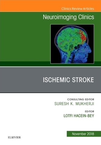 Ischemic Stroke, An Issue of Neuroimaging Clinics of North America