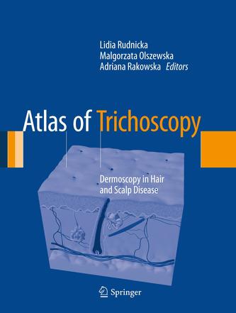 Atlas of Trichoscopy
