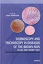 Dermoscopy and Trichoscopy in Diseases of the Brown Skin