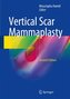 Vertical Scar Mammaplasty