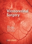 Vitreoretinal Surgery