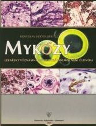 Mykózy - příručka a barevný atlas histopatologie mykotických onemocnění