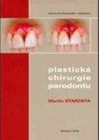 Plastická chirurgie parodontu