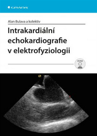 Intrakardiální echokardiografie v elektrofyziologii