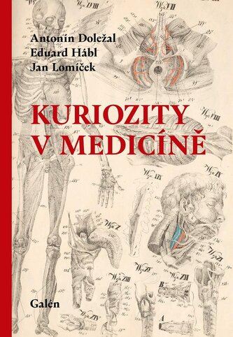 Kuriozity v medicíně Kuriozity v medicíně