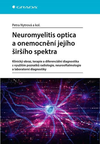 Neuromyelitis optica a poruchy jejího širšího spektra
