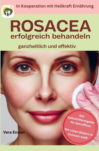 Rosacea erfolgreich behandeln - ganzheitlich und effektiv: Der Selbsthilferatgeber für Betroffene mit Tipps, die wirklich funkti