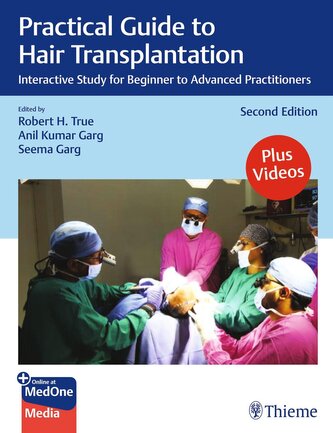 Practical Guide to Hair Transplantation