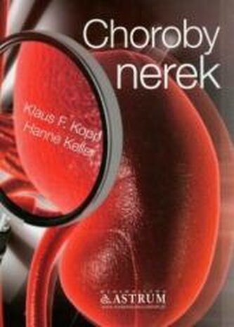 Choroby nerek Choroby nerek