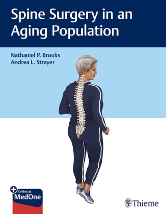 Spine Surgery in an Aging Population Spine Surgery in an Aging Population