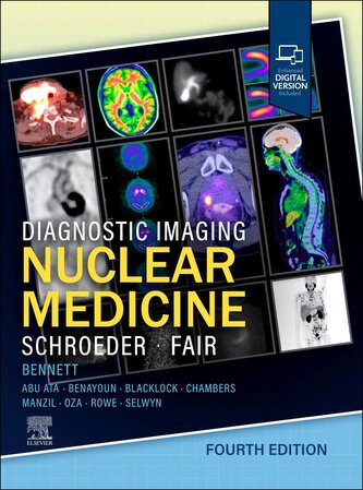Diagnostic Imaging: Nuclear Medicine