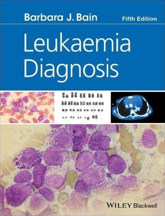 Leukaemia Diagnosis