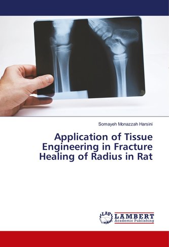 Application of Tissue Engineering in Fracture Healing of Radius in Rat