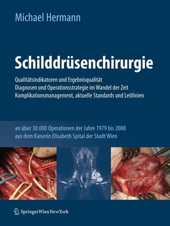 Schilddrüsenchirurgie - Qualitätsindikatoren und Ergebnisqualität, Diagnosen und Operationsstrategie im Wandel der Zeit, Komplik
