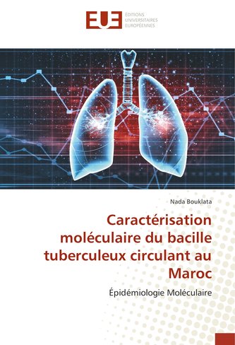 Caractérisation moléculaire du bacille tuberculeux circulant au Maroc