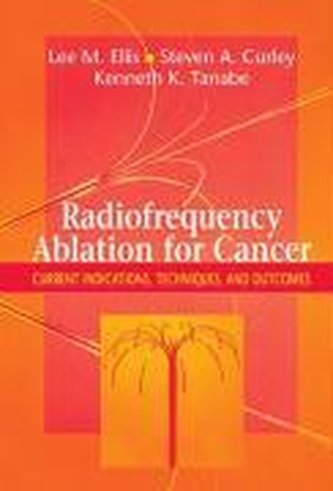 Radiofrequency Ablation for Cancer