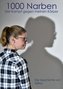 1000 Narben