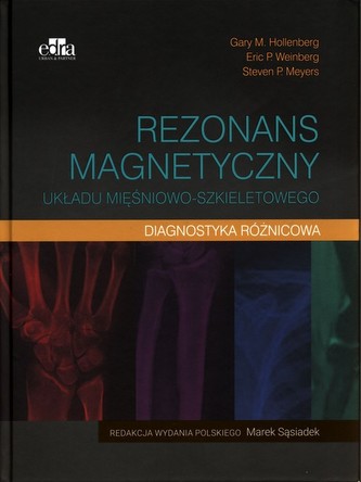 Rezonans magnetyczny układu mięśniowo-szkieletowego Diagnostyka różnicowa