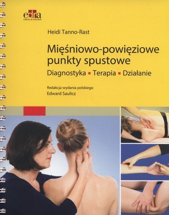 Mięśniowo-powięziowe punkty spustowe