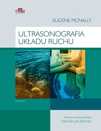 Ultrasonografia układu ruchu