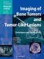 Imaging of Bone Tumors and Tumor-Like Lesions