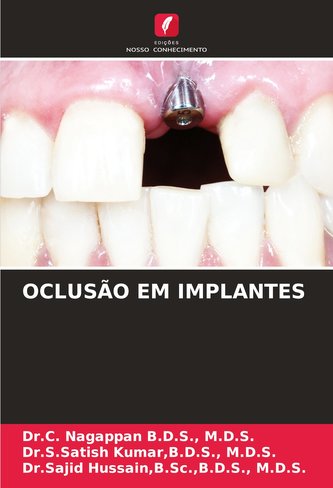 OCLUSÃO EM IMPLANTES