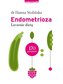 Endometrioza