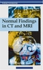 NORMAL FINDINGS IN CT AND MRI